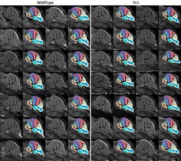 Tc1 Mouse cerebellum atlas