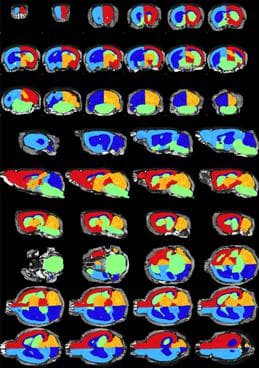 Multi-template MRI mouse brain atlas